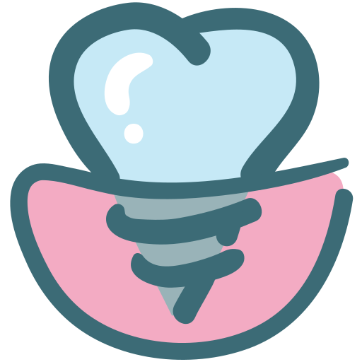 Ilustración de un implante dental de titanio